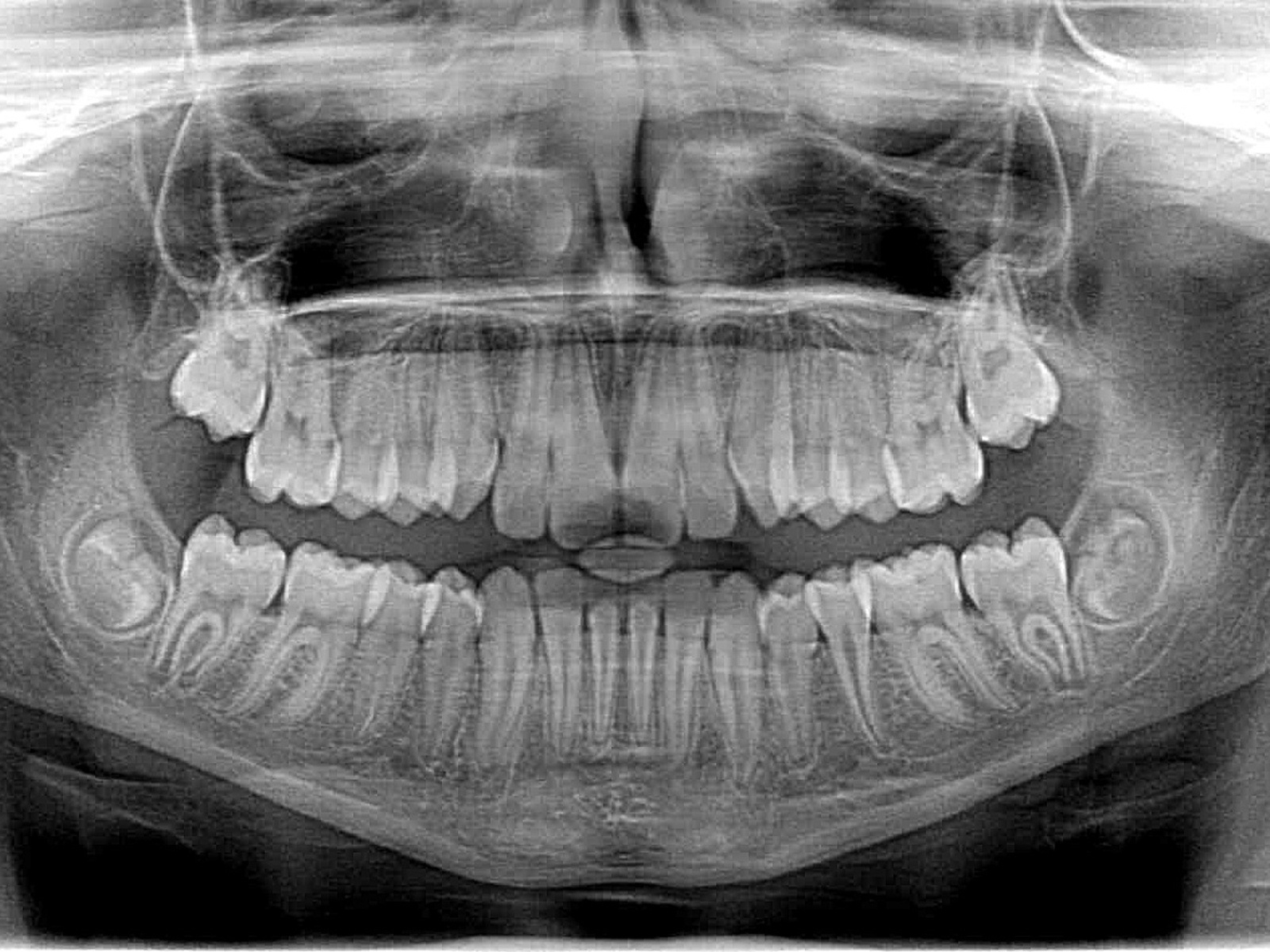 how-are-dental-x-rays-advantages