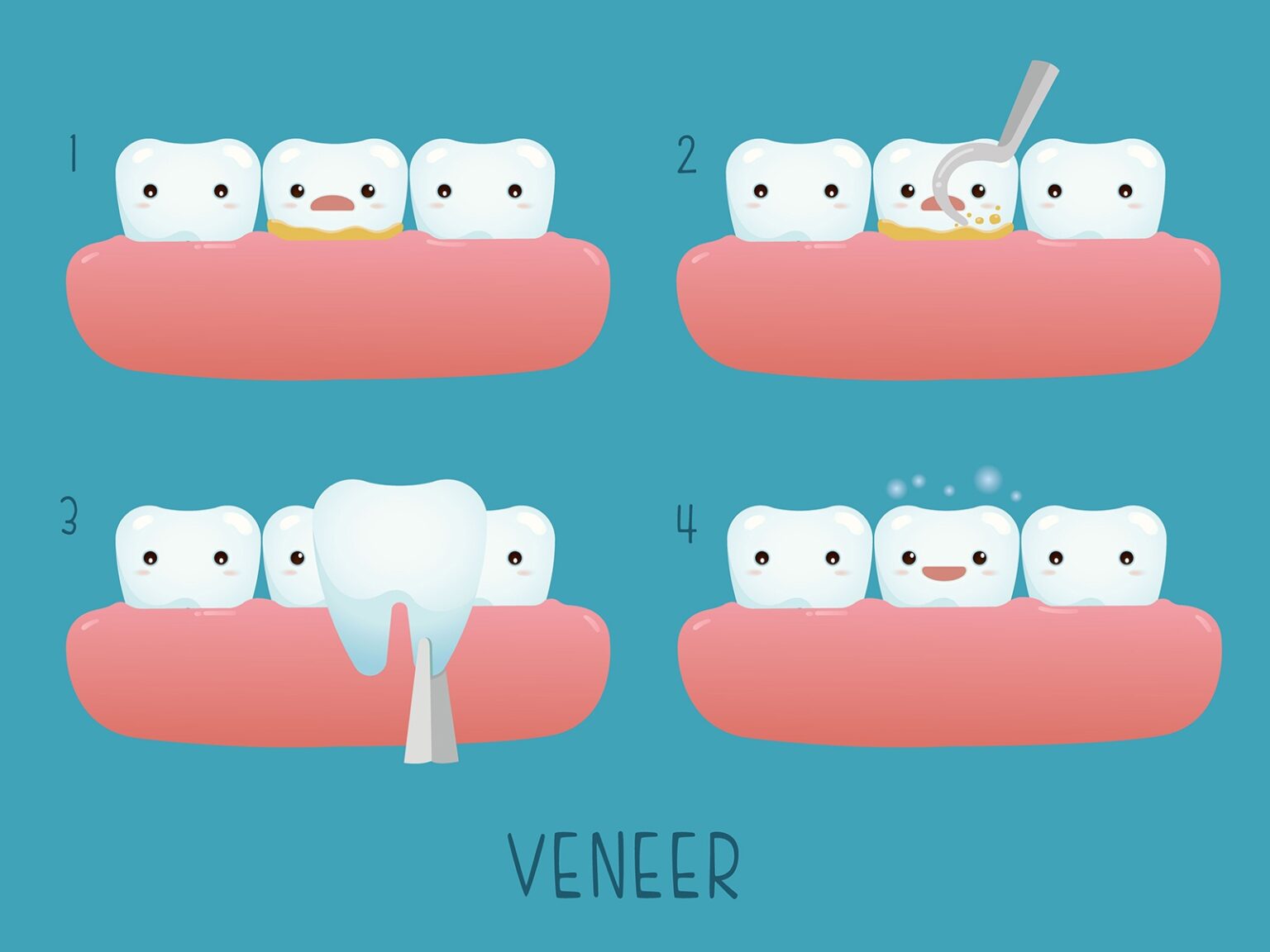 can-veneers-give-you-a-radiant-smile