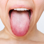 Causes of A White Tongue And How To Get Rid of It