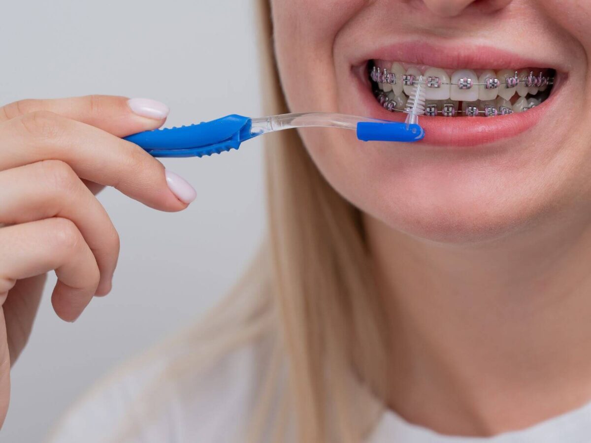 Tips For Pain After Getting Your Braces Tightened