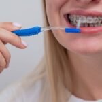 Tips For Pain After Getting Your Braces Tightened